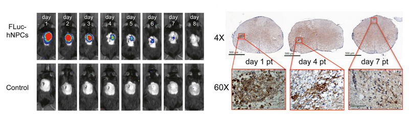 Illustration for article titled "Surprising" Breakthrough in Multiple Sclerosis Mouse Study